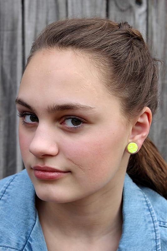 Summerfield Collection Stainless Steel Neon Yellow AB Faux Druzy Stone Stud Earrings (12mm)